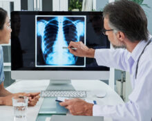 Doctor and patient looking at lung cancer diagnosis