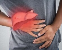 Liver cancer symptoms