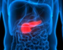 Pancreatic cancer in Singapore