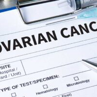 Ovarian Cancer Risk Factors