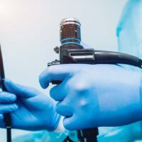 Endoscopy at the hospital. Doctor holding endoscope before gastroscopy. Medical examination, colonoscopy singapore