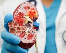 Chronic kidney disease in Singapore