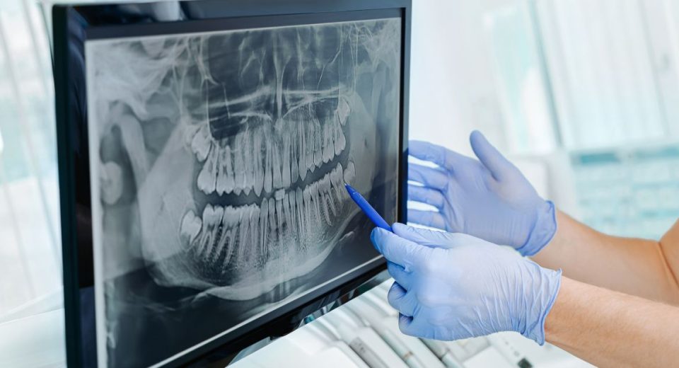 Dental screening