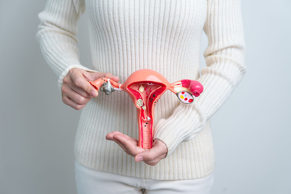 Woman,Holding,Uterus,And,Ovaries,Model.,Ovarian,And,Cervical,Cancer, Woman holding Uterus and Ovaries model. Ovarian and Cervical cancer, Cervix disorder, Endometriosis, Hysterectomy, Uterine fibroids, Reproductive system and Pregnancy concept