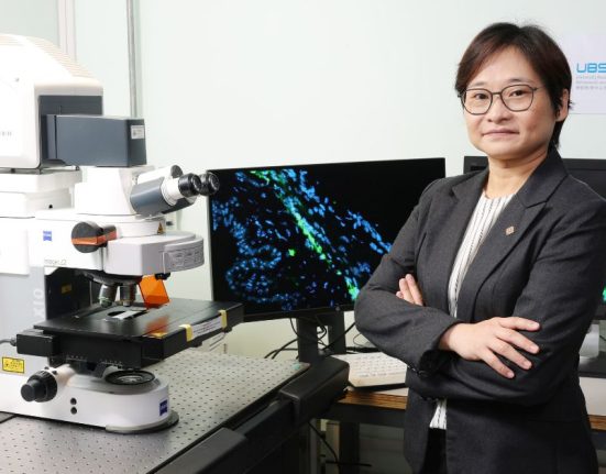 Dr Samantha Shan, Research Assistant Professor of the School of Optometry of PolyU