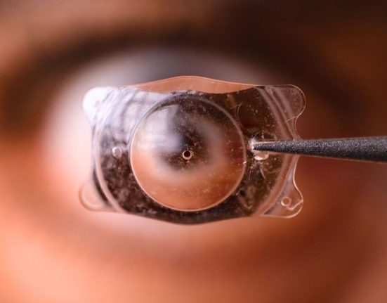 Implantable Contact Lens