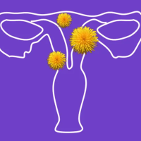 uterine fibroids image women's health gynecological conditions