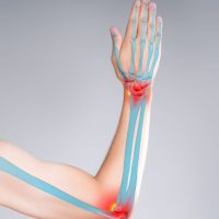 Upper Limbs - Bone And Orthopaedic Health