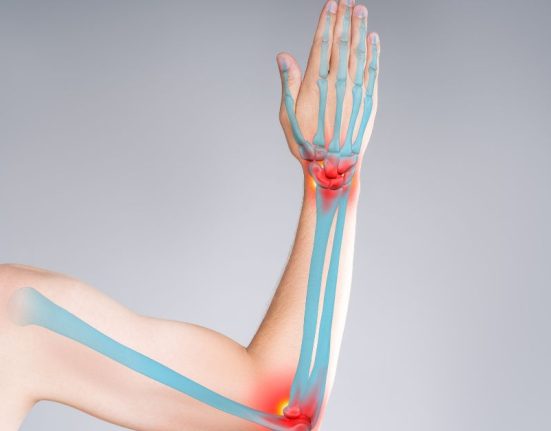 Upper Limbs - Bone And Orthopaedic Health