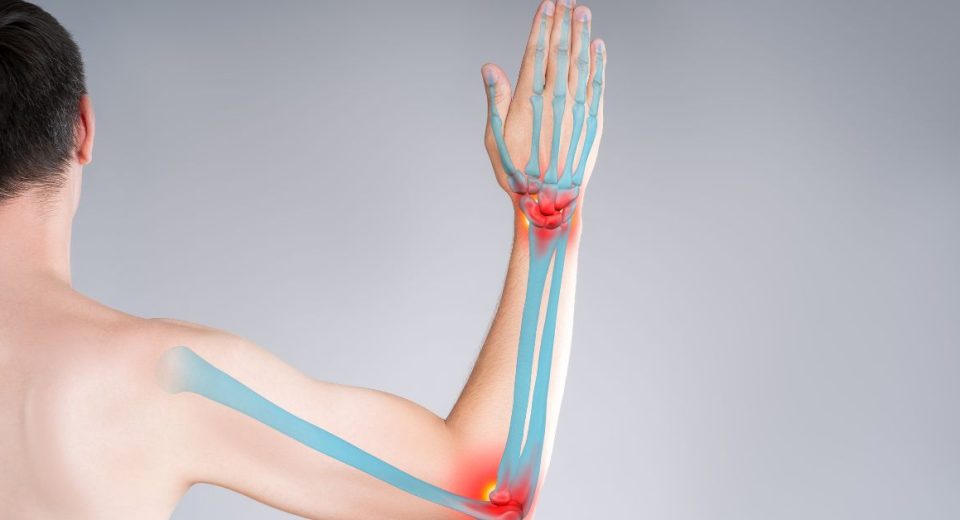 Upper Limbs - Bone And Orthopaedic Health