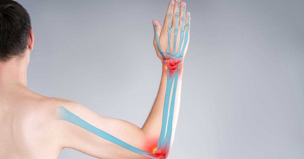 Upper Limbs - Bone And Orthopaedic Health