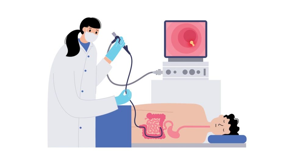 Get a colonoscopy screening in Singapore