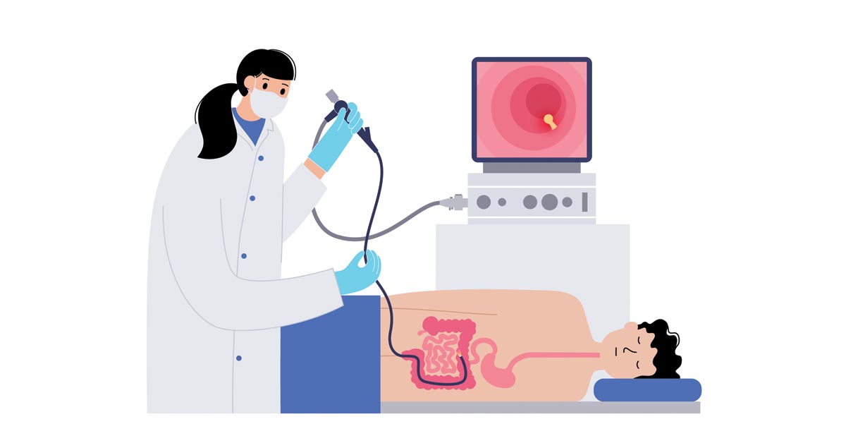 Get a colonoscopy screening in Singapore