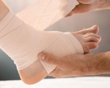 sprained ankle treatment singapore