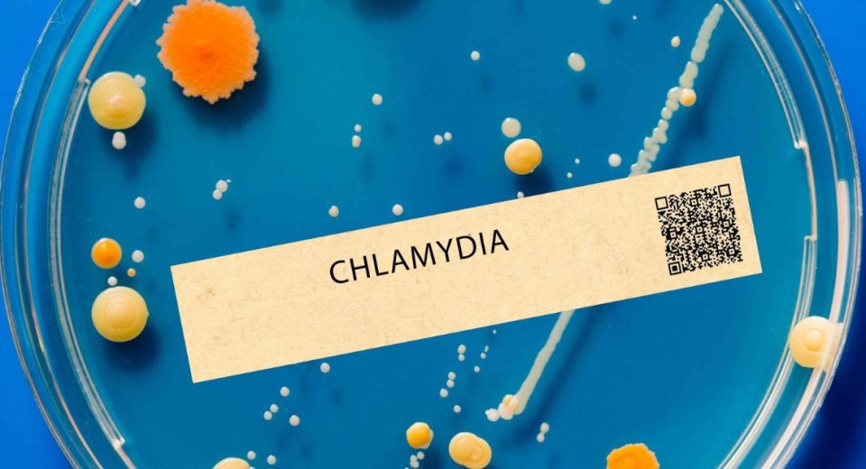 chlamydia symptoms