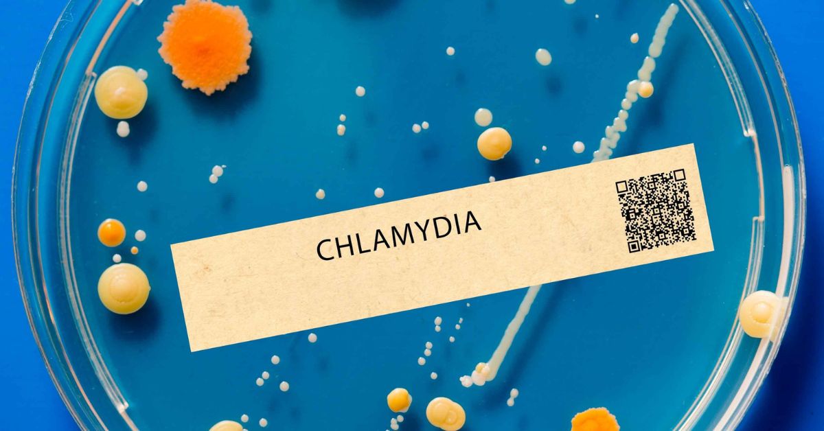 chlamydia symptoms