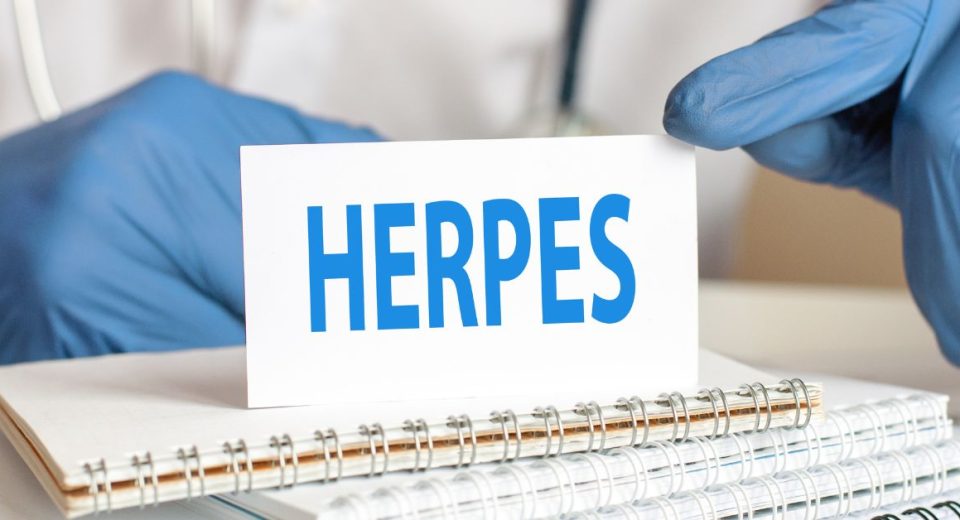 genital herpes symptoms