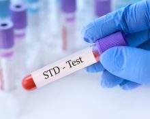 std test singapore