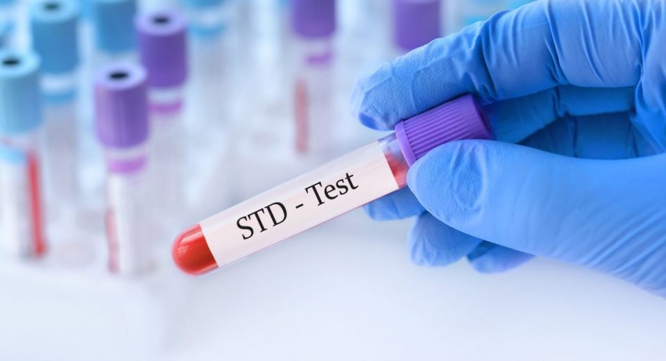 std test singapore