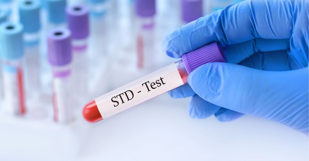 std test singapore