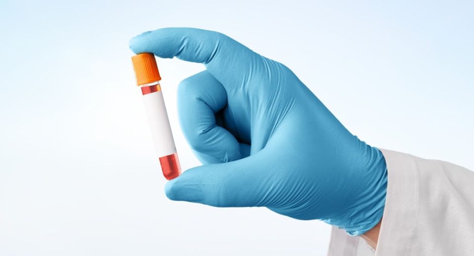 stomach cancer blood test, cancer screening in Singapore