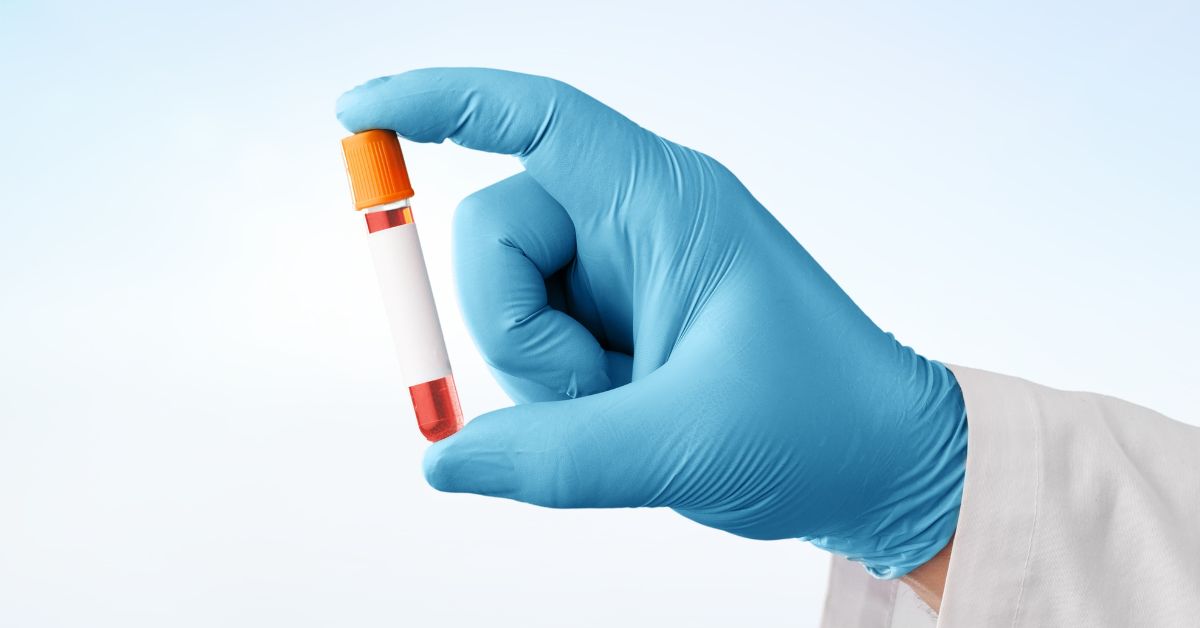 stomach cancer blood test