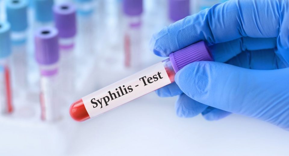 syphilis test