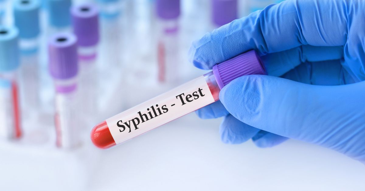 syphilis test