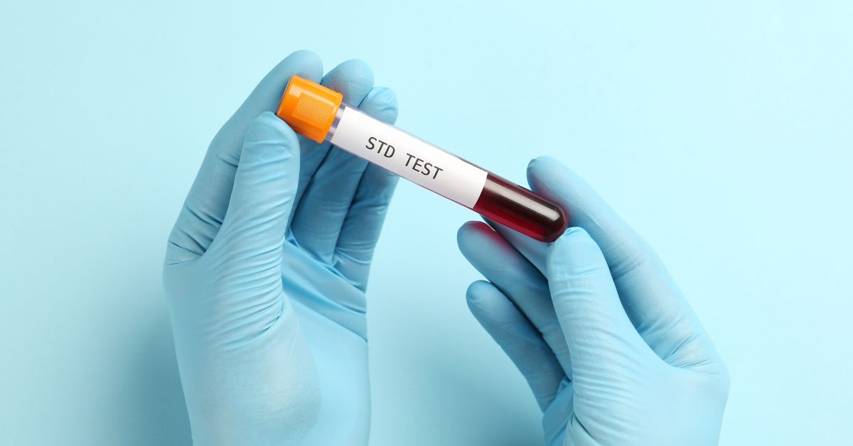 STD Testing