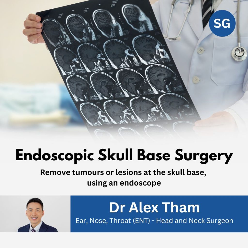 Dr Alex Tham, ENT Doctor Singapore - SKU