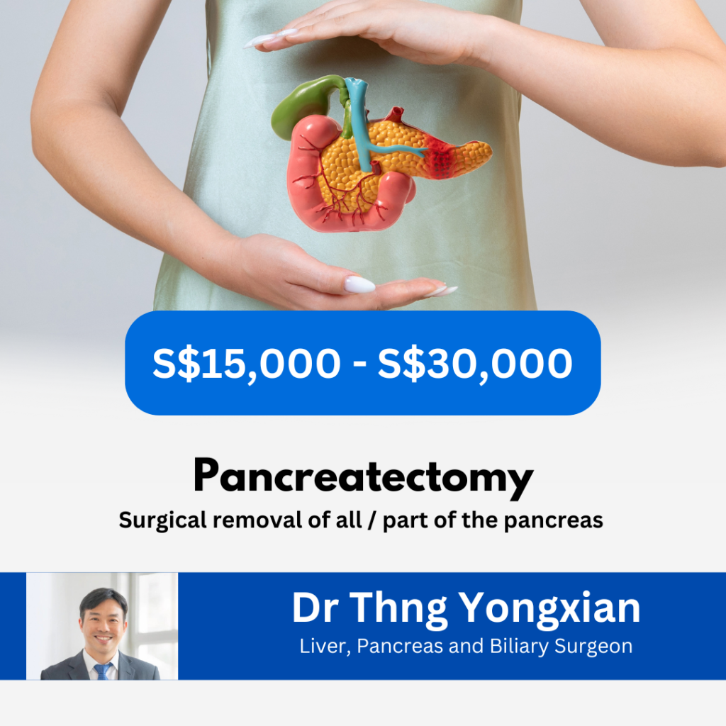 Dr Thng Yongxian - pancreatectomy SKU