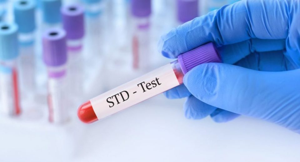 cheap std test singapore