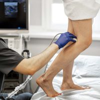 Varicose veins treatment