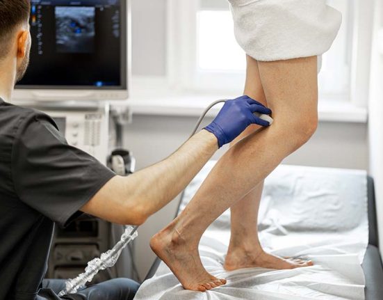 Varicose veins treatment