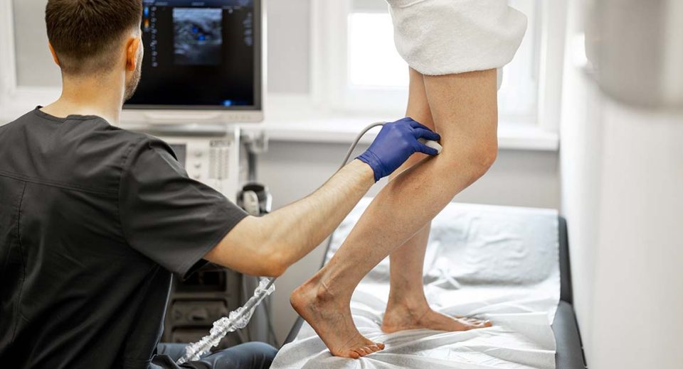 Varicose veins treatment