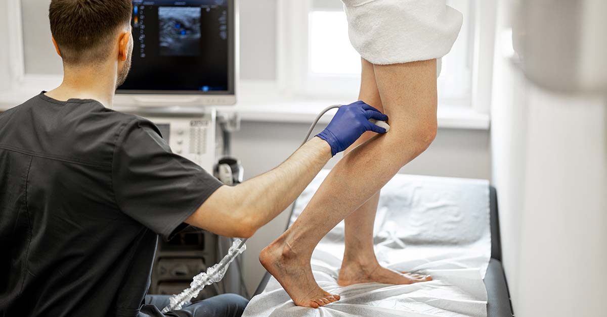 Varicose veins treatment