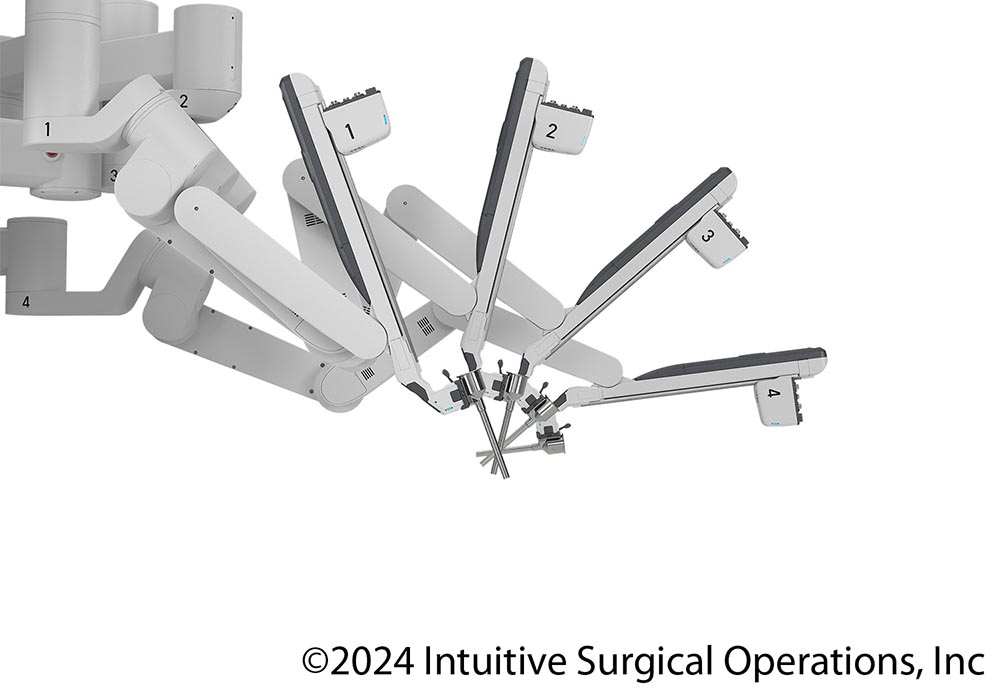 da Vinci - Robotic Surgery