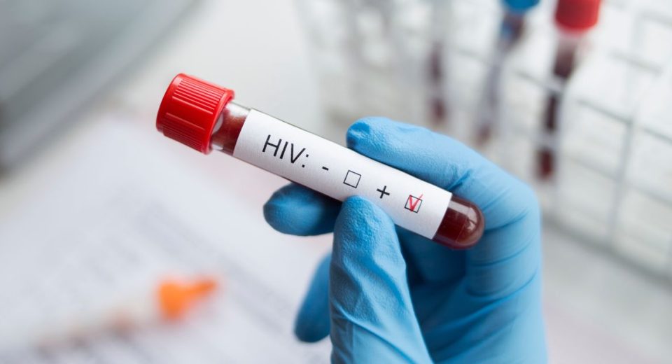 hiv test singapore cost