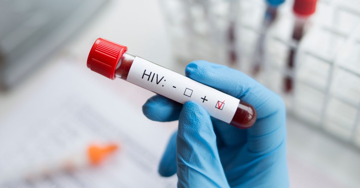 hiv test singapore cost