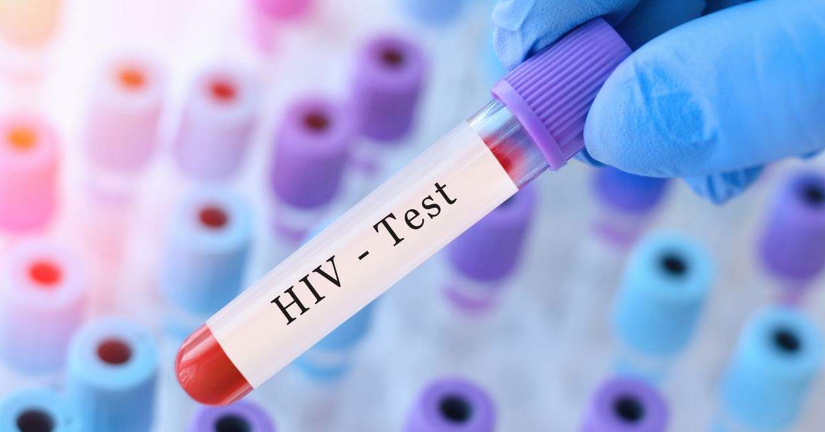 hiv test singapore