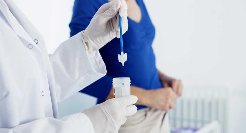 pap smear test singapore