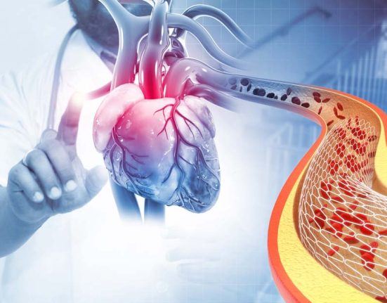 Stent or bypass