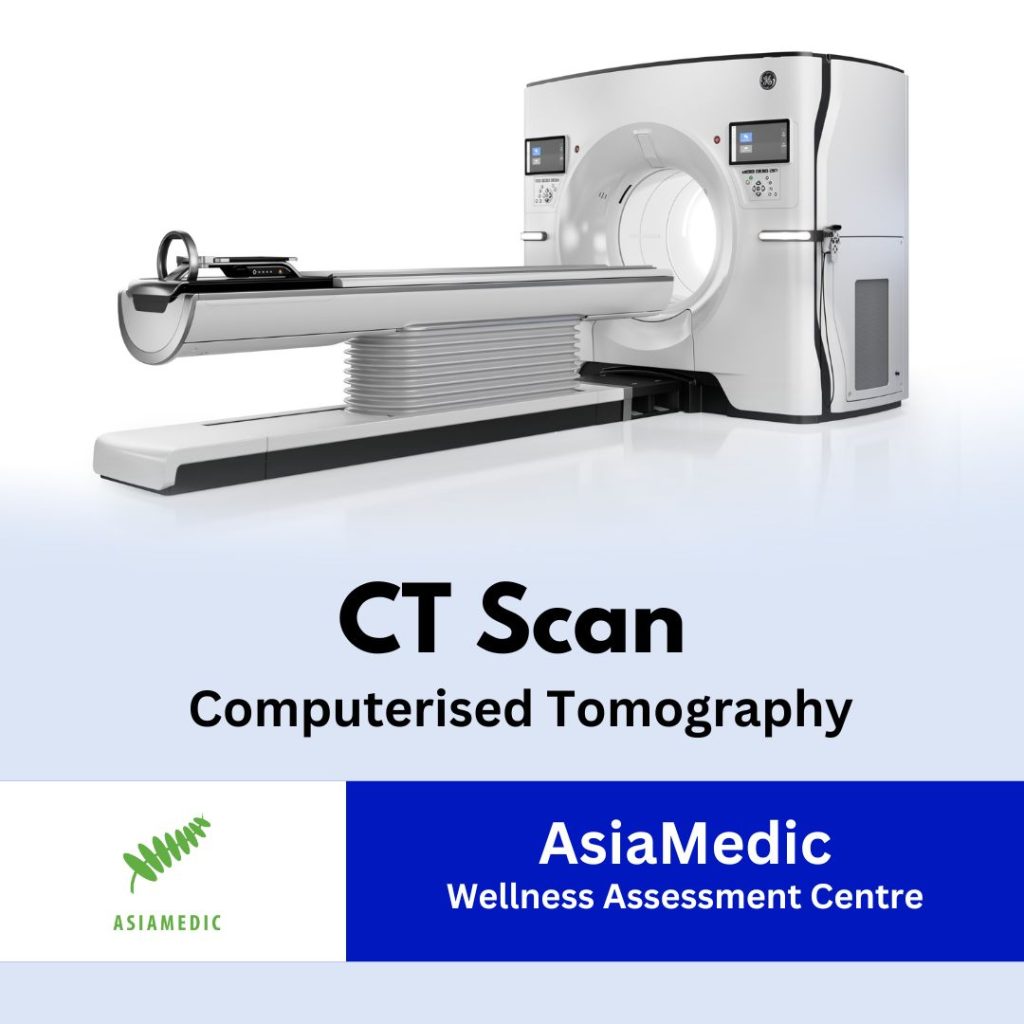 CT Scan SKU