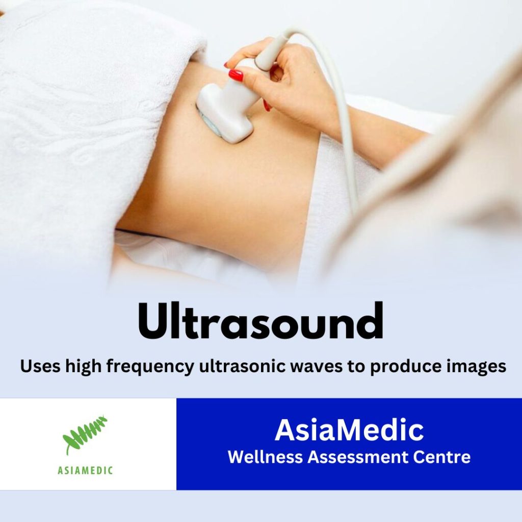 Ultrasound SKU