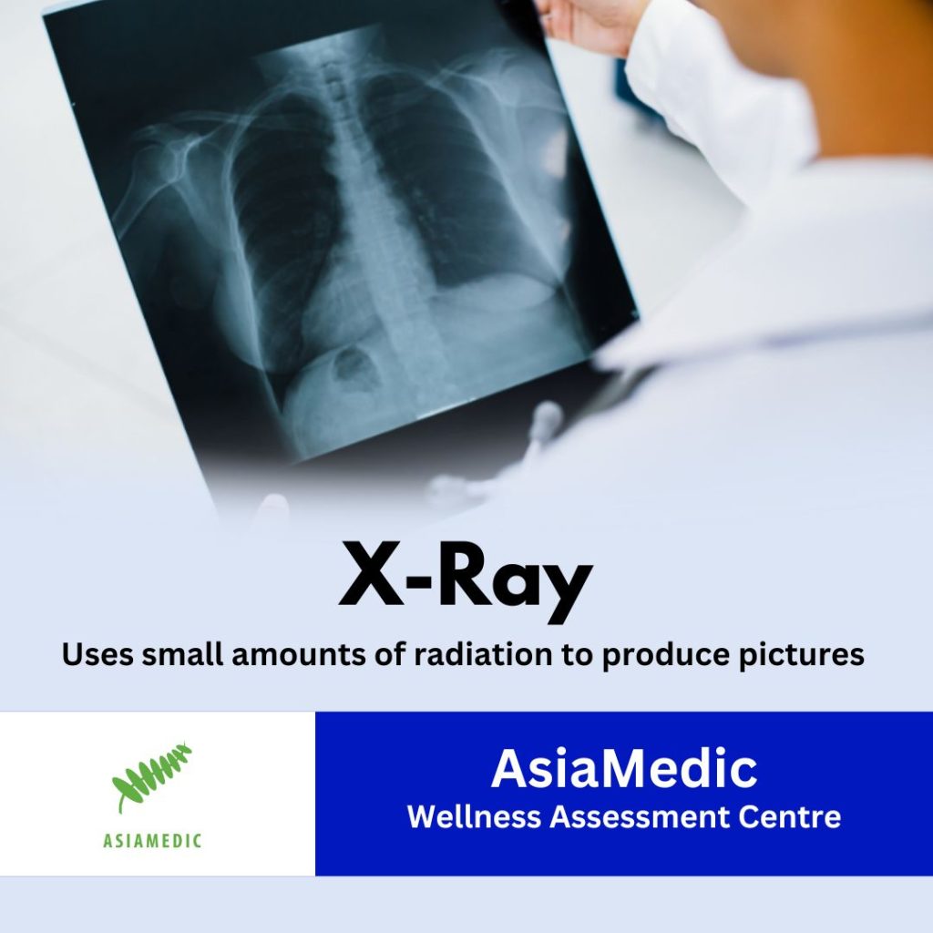 X-Ray SKU