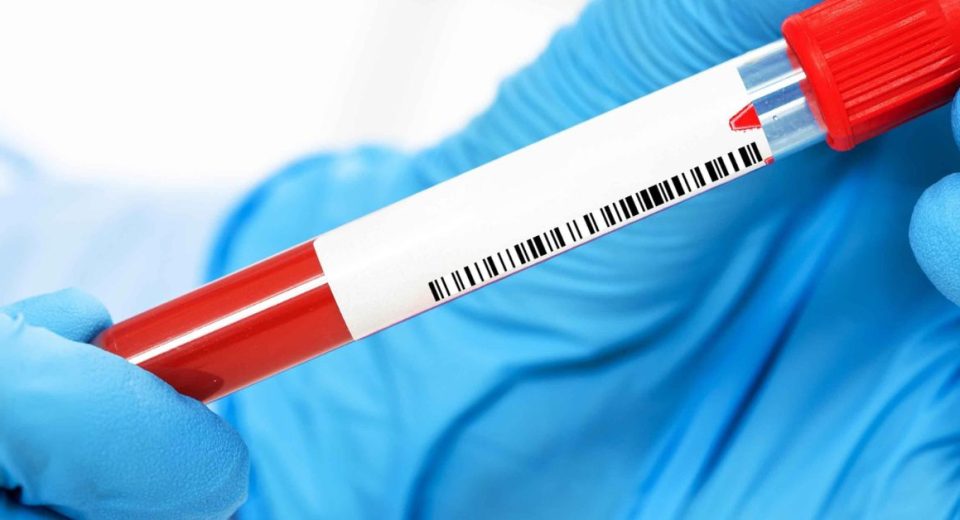 blood test for cancer markers​