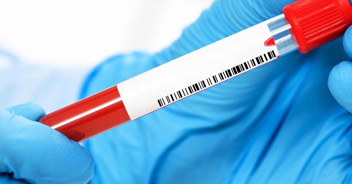 blood test for cancer markers​