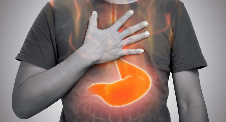 Indigestion may be an indicator of stomach cancer