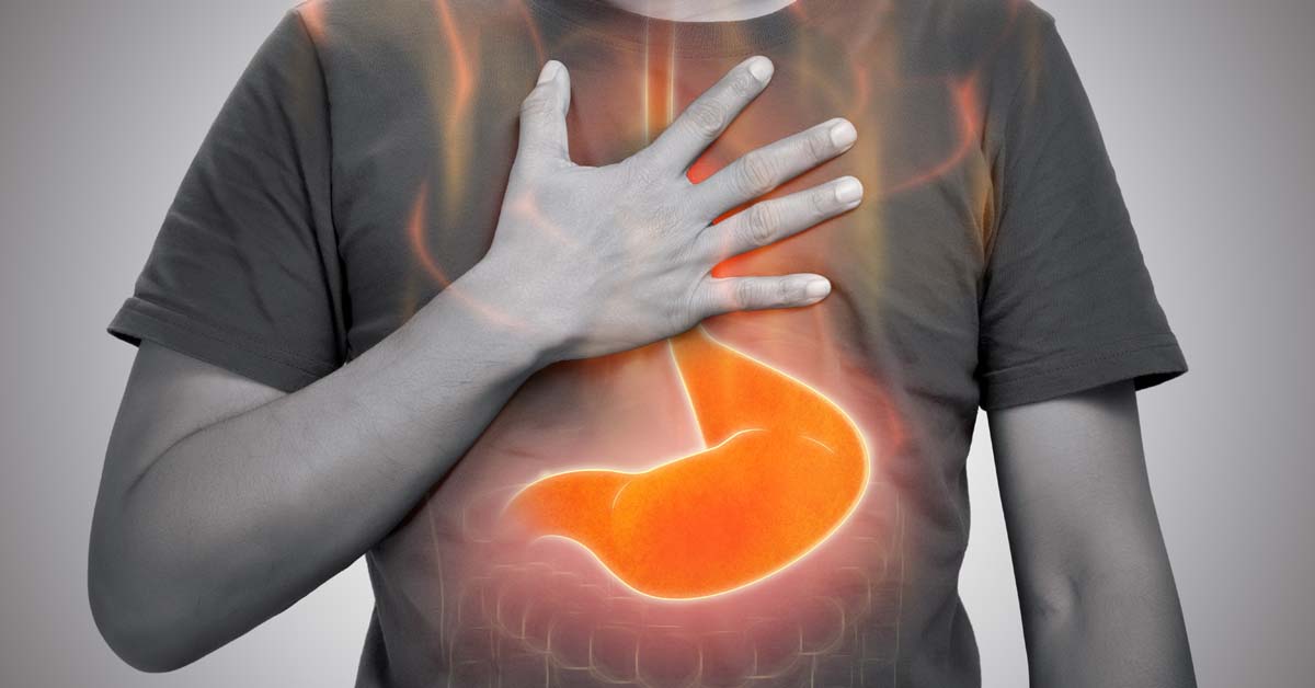 Indigestion may be an indicator of stomach cancer