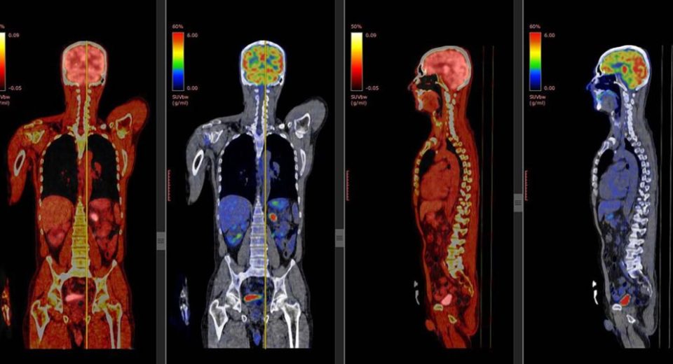 PET Scan Singapore